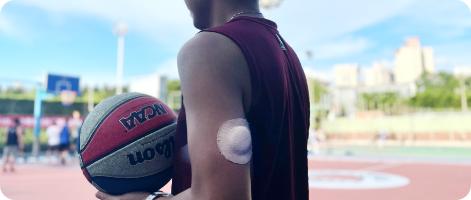 Kovoq CEO is now using Gen 2 protection solution for his Libre 2 sensors